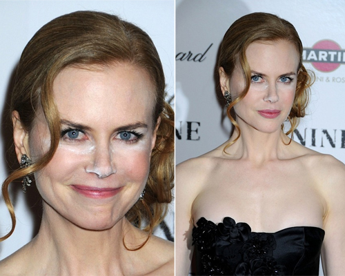 Nicole Kidman