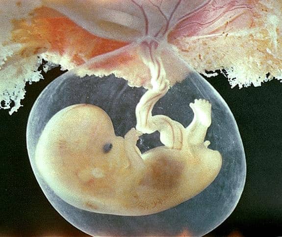 feto 9 settimane