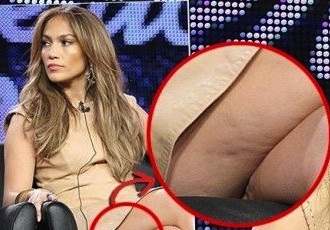 Jennifer_Lopez_e_lo_choc_della_cellulite