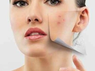 Minerale missha ghassoul nero che stringe la maschera di maschera