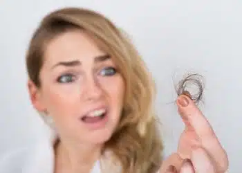 perche le donne perdono i capelli